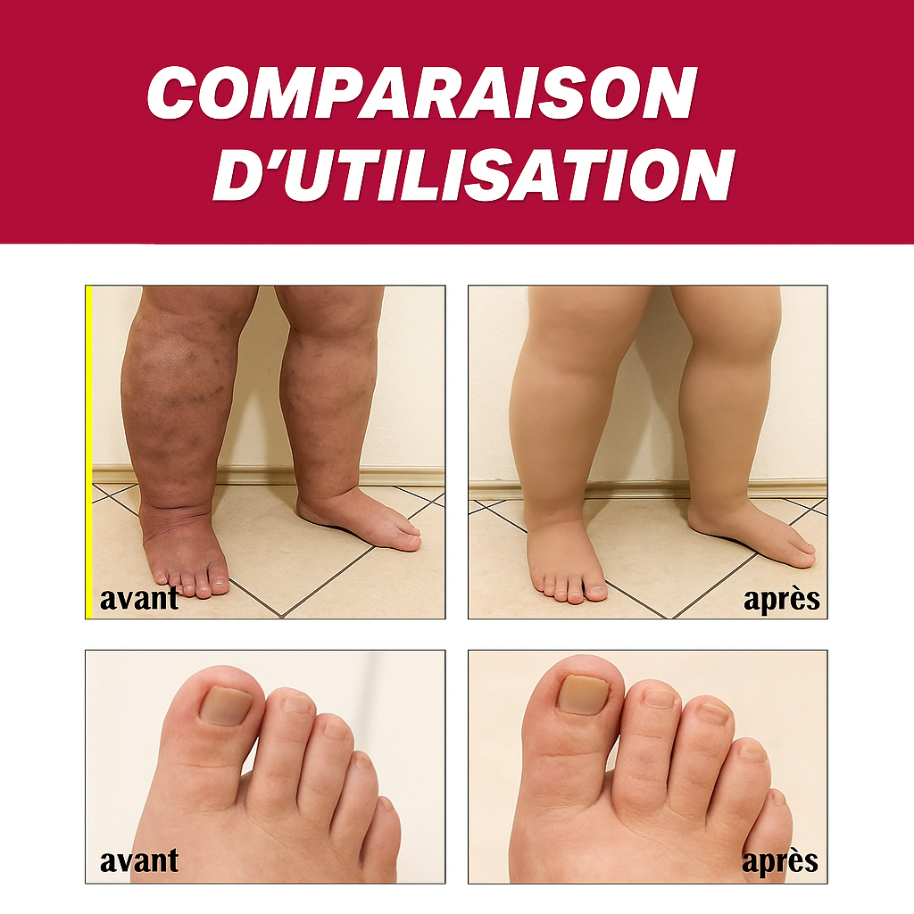 Crème contre la polyarthrose rhumatoïde