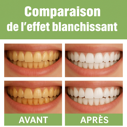 Sérum de Blanchiment Dentaire – Sourire Éclatant & Haleine Fraîche